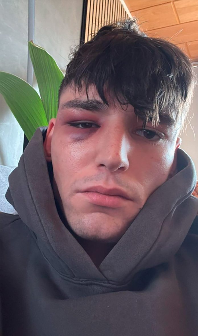 El escabroso giro en el caso del árbitro alemán agredido tras pedirle matrimonio a su novio antes de un partido