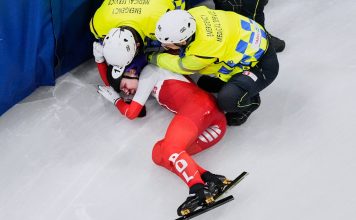 El calvario de la patinadora que sufrió un escalofriante corte en la cara durante los Juegos Olímpicos: “Tengo una placa de titanio”