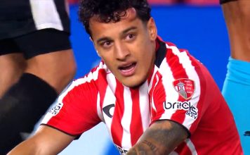 Cabeceó a un rival, quedó con una impactante secuela en su rostro y es duda para jugar el clásico de La Plata