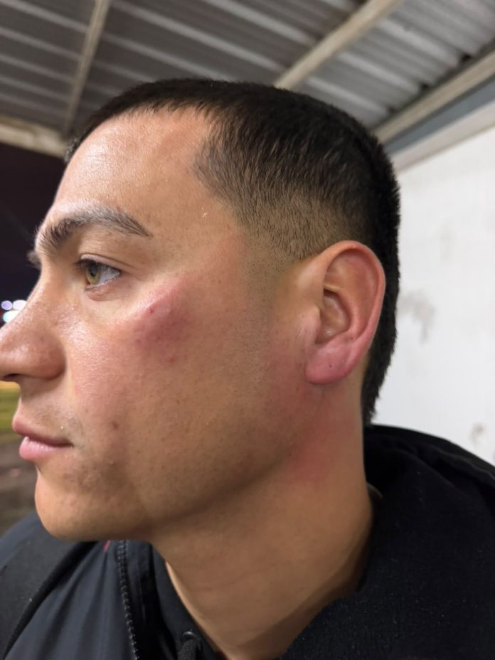 Escándalo por la brutal agresión que sufrieron los jugadores de un plantel del fútbol argentino tras perder un partido